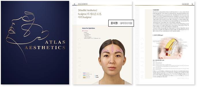 Sculptra의 새로운 도전, 이마 Sculptra