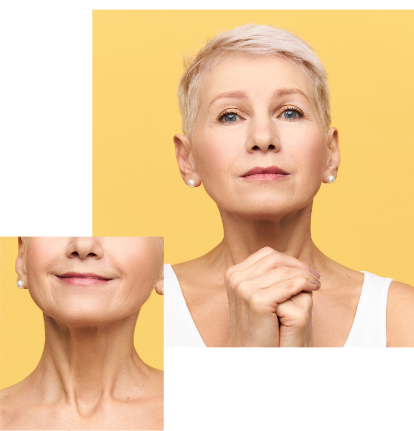 연령대별 울쎄라 가이드(40–50대)