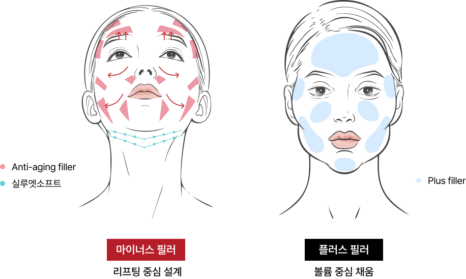 마이너스 필러, 플러스 필러비교